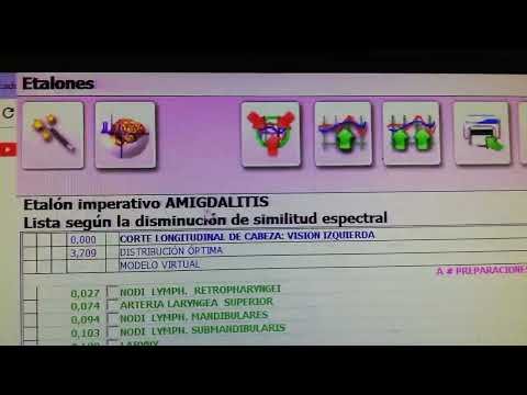 Metatron Hunter — intelligenter Filter (Bioresonanz- und Biofeedback-Kurs)
