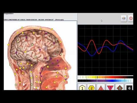 Metatron Hunter — terapia con fitoterapia | Héctor Arias