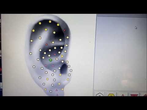 Biophilia Tracker — auriculoterapia con dispositivo