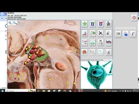 Glándula pineal (epífisis) — Metatron y Biophilia