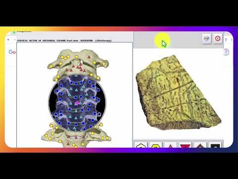 Metatron Hunter — терапия на шийните прешлени
