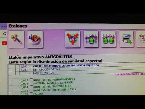 Akıllı filtre fonksiyonu